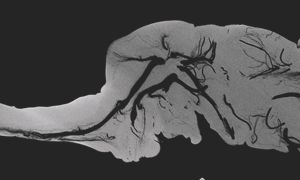 カブト虫蛹の断面CT画像