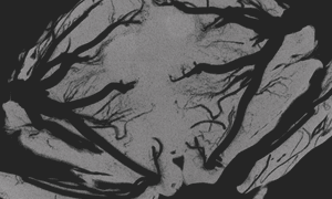 気管の見えるカブト虫蛹の断面CT画像