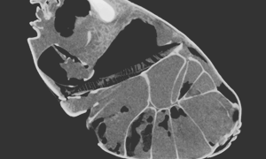 アカテガニを縦に切った断面CT画像
