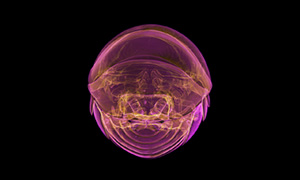 ダンゴムシのX線透過像