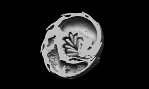 ダンゴムシの断層画像