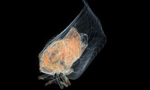 ヘリチャハゴロモの断層画像