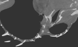 ハリセンボンを横に切った断面CT画像