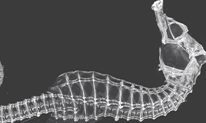タツノオトシゴ骨のCT画像